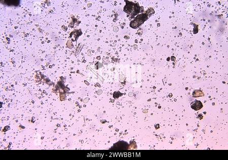 This photomicrograph of an unstained specimen revealed the presence of ...