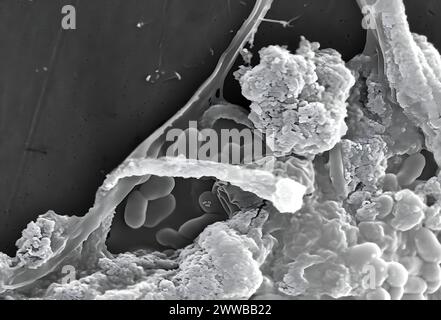 This scanning electron microscopic (SEM) image of an untreated water ...