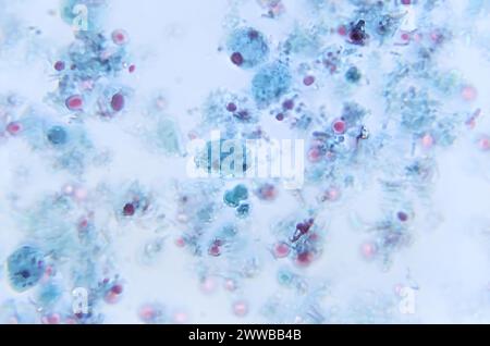 Under 1150X magnification, this photomicrograph of a trichrome-stained ...