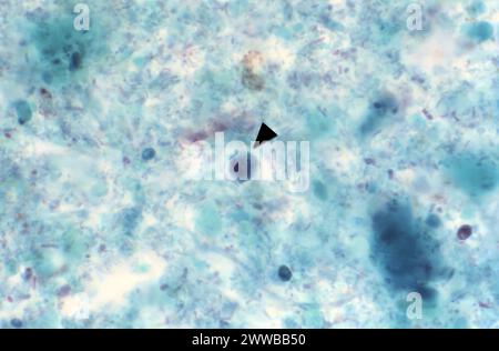 This photomicrograph revealed the presence of both an Entamoeba ...