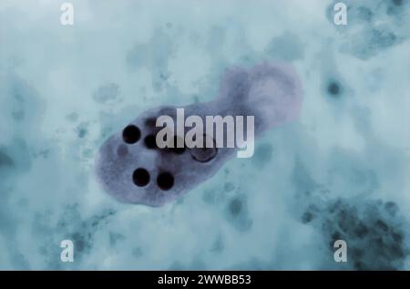 This photomicrograph of a trichrome-stained specimen revealed the ...