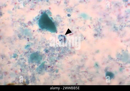 This photomicrograph revealed the presence of both an Entamoeba ...