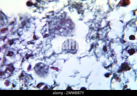 Under 900X magnification, this photomicrograph revealed the presence of ...