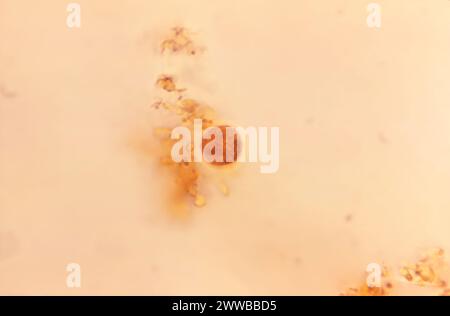 This photomicrograph revealed the presence of both an Entamoeba ...