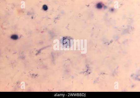 This photomicrograph revealed the presence of both an Entamoeba ...