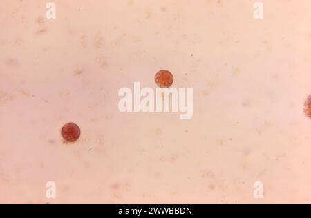 Under 500X magnification, this photomicrograph revealed the presence of ...