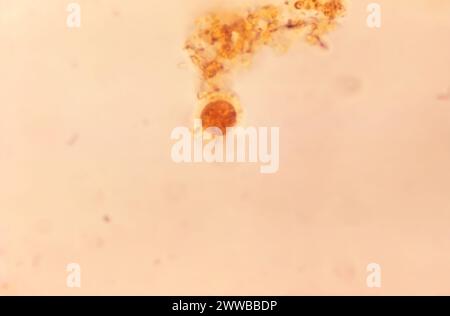 This photomicrograph revealed the presence of both an Entamoeba ...
