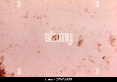 Under 500X magnification, this photomicrograph revealed the presence of ...