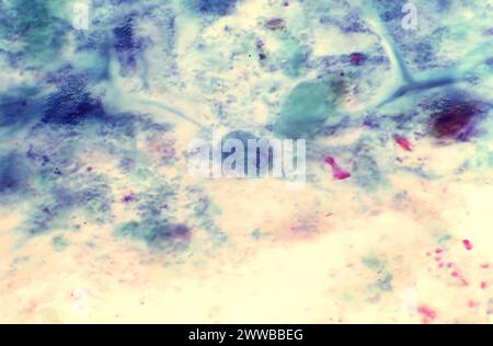 This photomicrograph of a specimen stained with Wheatleys trichrome ...
