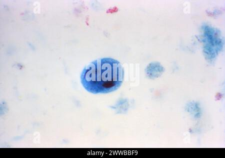 This photomicrograph of a trichrome-stained specimen revealed an ...