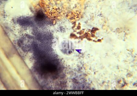 This photomicrograph of an iron-hematoxylin-stained specimen, revealed ...