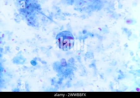 Under 1150X magnification, this photomicrograph of a trichrome stained ...
