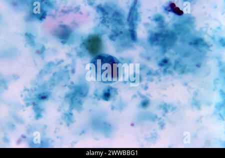 This photomicrograph of a trichrome-stained specimen revealed the ...