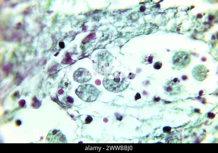 Under 675X magnification, this photomicrograph revealed the presence of ...