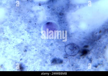 Under 900X magnification, this photomicrograph revealed the presence of ...