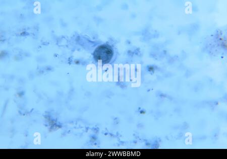 Under 900X magnification, this photomicrograph revealed the presence of ...