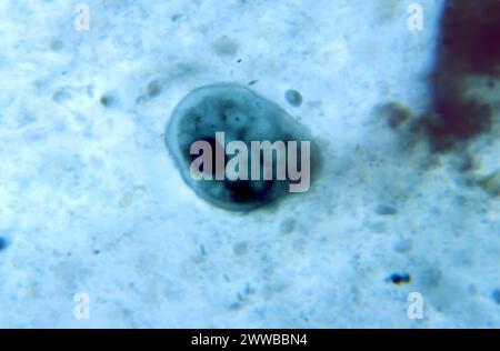 Under 900X magnification, this photomicrograph revealed the presence of ...