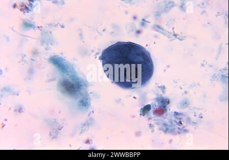 Under 1125X magnification, this photomicrograph revealed the presence ...
