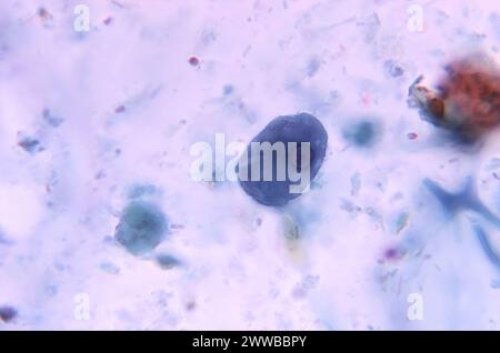 Under 1125X magnification, this photomicrograph revealed the presence ...