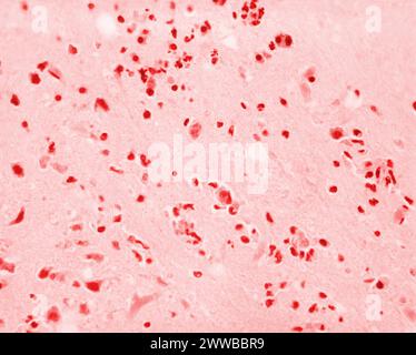 Under 500X magnification, this 1973 photomicrograph of a trichrome ...