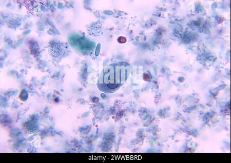 This photomicrograph revealed the presence of an Entamoeba histolytica ...