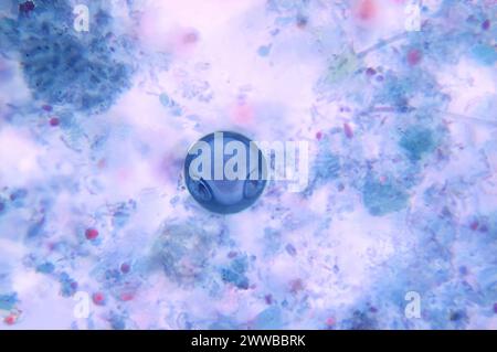 This photomicrograph revealed the presence of a binucleate parasitic ...