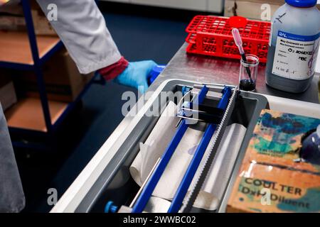 Technical platform of the Inovie 34 laboratory . Staining of a malaria slide and diagnostic smear to rule out malaria in a patient. Stock Photo