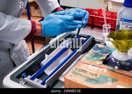 Technical platform of the Inovie 34 laboratory . Staining of a malaria slide and diagnostic smear to rule out malaria in a patient. Stock Photo