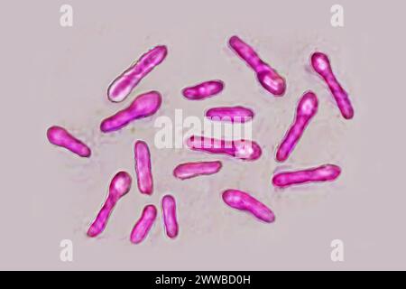Clostridium botulinum bacteria (botulism bacillus). Stock Photo