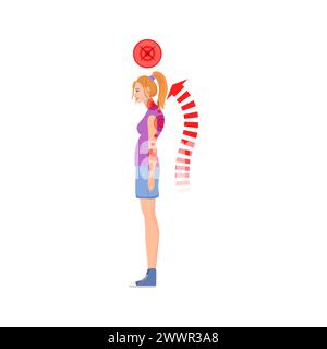 Standing woman with incorrect spine posture. Spine health, bad body ...