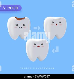 Step of Tooth Filling Illustration Vector on Blue Background. Dental Care Concept. Treatment Of Caries. Stock Vector