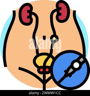 ureteroscopy urology color icon vector illustration Stock Vector Image ...