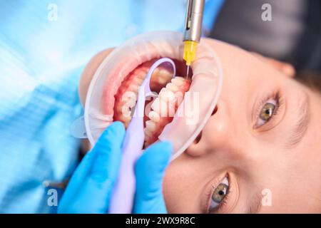 Doctor gives injection of anesthesia in gum of teenage girl Stock Photo