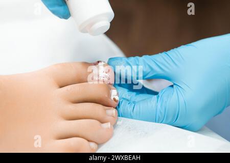 Antibiotic powder is used for treating various fungal or bacterial infections on the toenails by podologist in the clinic Stock Photo