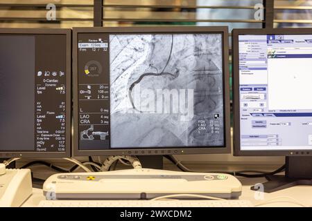 Angiogram sequence working clockwise using x-rays with a contrast agent injected from a tube inserted into the arteries (left & centre), to show the h Stock Photo