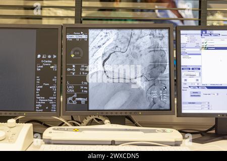 Angiogram sequence working clockwise using x-rays with a contrast agent injected from a tube inserted into the arteries (left & centre), to show the h Stock Photo