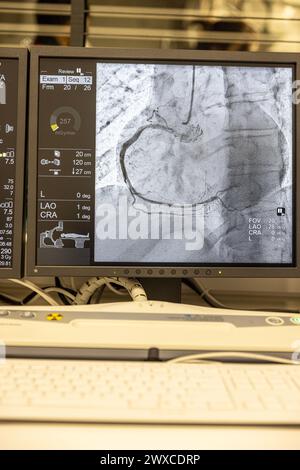 Angiogram sequence working clockwise using x-rays with a contrast agent injected from a tube inserted into the arteries (left & centre), to show the h Stock Photo