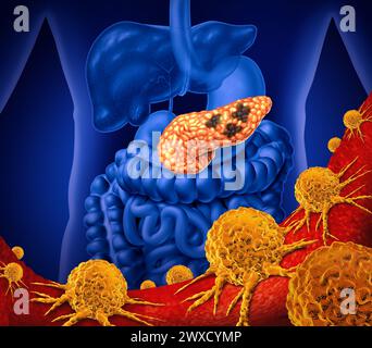 Pancreatic cancer concept and Pancreas malignant tumor symbol as a digestive gland body part inside the human body. Stock Photo