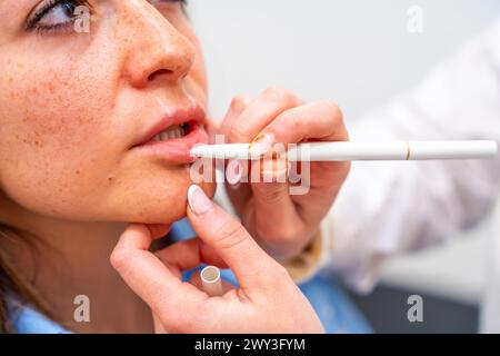 Beautician draw correction lines on woman lips to fill it with hyaluronic acid in the clinic Stock Photo