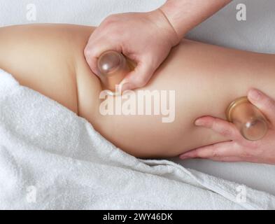 The masseur makes massage with jars of cellulite on the buttock and thighs of the patient. Treatment of excess weight. Stock Photo