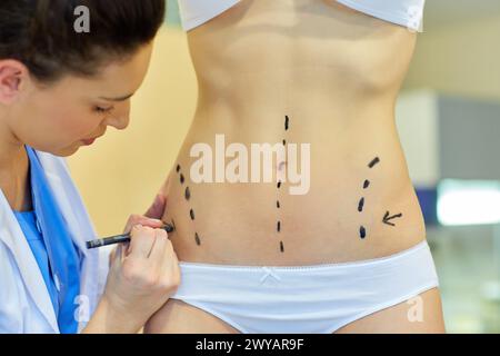 Abdomen. Tummy tuck. It is retensioning skin and abdominal muscles, by removing redundant skin and musculature plication. Before surgery should be taken anatomical references, such as the midline of the abdomen and the height of the anterior superior iliac spine. Plastic surgery. Doctor attending to patient medical consultation. Stock Photo