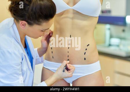 Abdomen. Tummy tuck. It is retensioning skin and abdominal muscles, by removing redundant skin and musculature plication. Before surgery should be taken anatomical references, such as the midline of the abdomen and the height of the anterior superior iliac spine. Plastic surgery. Doctor attending to patient medical consultation. Stock Photo