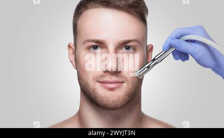 A cosmetologist is making the procedure Microdermabrasion of the facial skin in a beauty salon. Cosmetology for men and professional skin care. Stock Photo