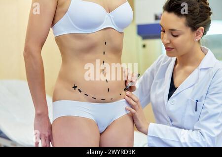 Abdomen. Tummy tuck. It is retensioning skin and abdominal muscles, by removing redundant skin and musculature plication. Before surgery should be taken anatomical references, such as the midline of the abdomen and the height of the anterior superior iliac spine. Plastic surgery. Doctor attending to patient medical consultation. Stock Photo