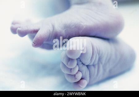 Newborn, phototherapy. Stock Photo