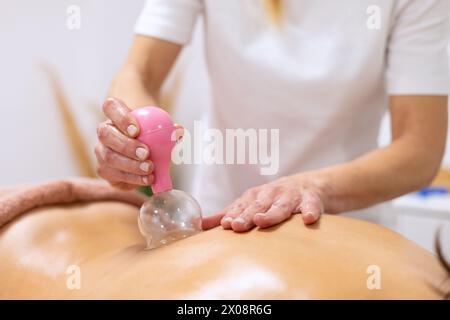 Close-up of a therapist performing cupping therapy using a pink silicone suction cup on a patient, depicting alternative medicine practice Stock Photo