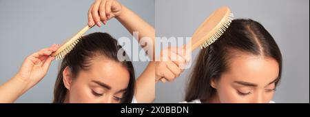 Woman before and after hair treatment with high frequency darsonval device on grey background, closeup. Collage of photos Stock Photo