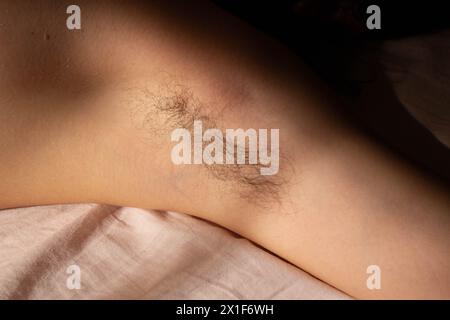 Challenge beauty standards and celebrate natural authenticity with this empowering image of a female armpit adorned with hair Stock Photo