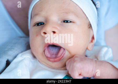 The newborn has thrush on his tongue. Baby diseases. Baby care. Thrush, a fungal infection that occurs in the mouth or on the tongue surface, is a dis Stock Photo