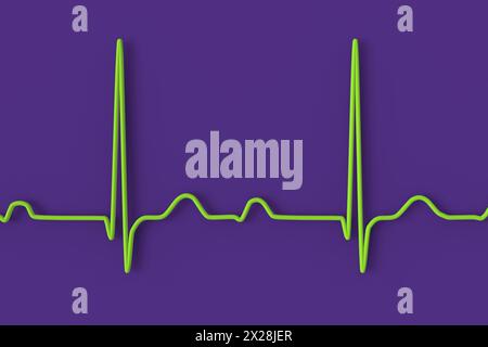 Computer illustration of an ECG (electrocardiogram) displaying first ...